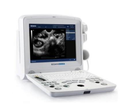 Edan DUS 60 portable ultrasound system