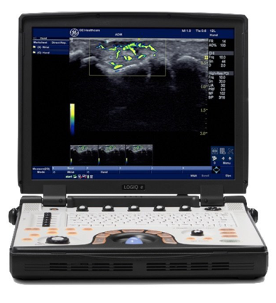 GE Logiq E NextGen Portable Ultrasound Machine