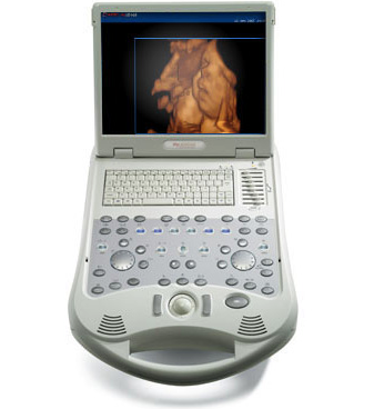 Esaote Biosound MyLab 25 Gold portable ultrasound system