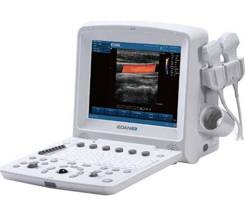 Edan U50 portable ultrasound system