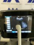 Chison V6 Endocavitary Ultrasound Probe