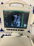 Bard Site Rite 5 Ultrasound System