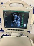 Bard Site Rite 5 Ultrasound System