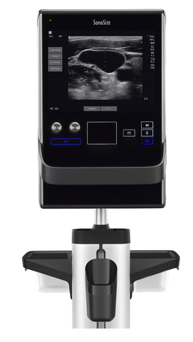 Sonosite SII Portable Ultrasound System