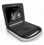 Edge Portable Ultrasound