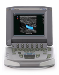 Sonosite Titan Portable Ultrasound System