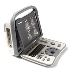 Sonoscape A6 Portable Ultrasound System