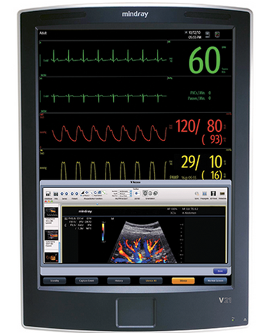 Mindray V21 Patient Monitor